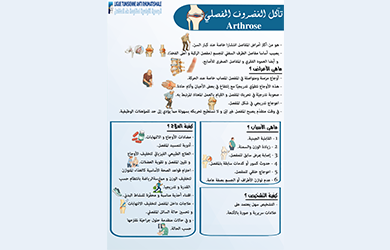تآكل الغضروف المفصلي - Arthrose
